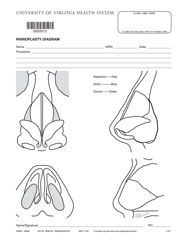  Rhinoplasty 2010-2024