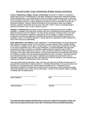 Informed Consent Crown OnlaysInlays Bridges Veneers Agd