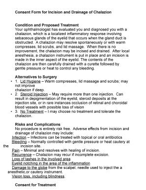 Chalazion Consent Form