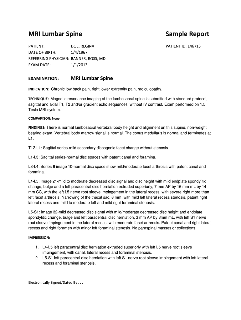 Mri Lumbar Spine Report Sample  Form