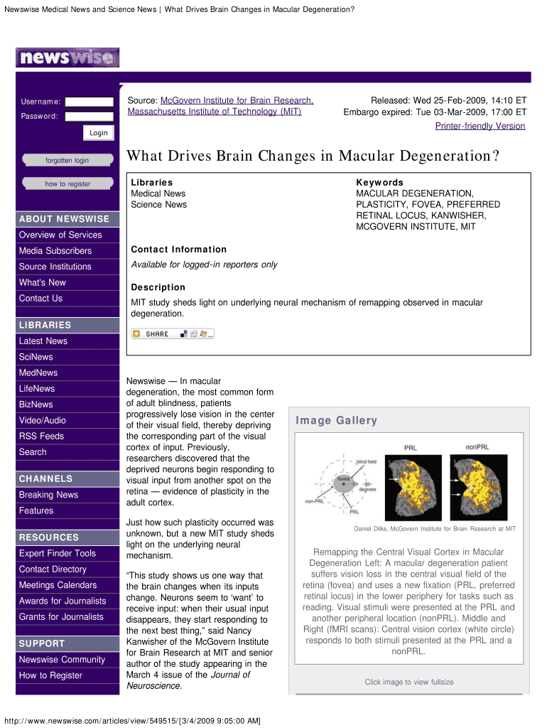 Newswise Medical News and Science News What Drives Brain Changes in Macular Degeneration?  Form