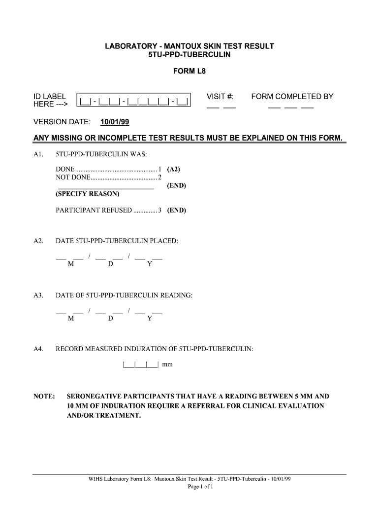  Sample Ppd Test Result 1999-2024