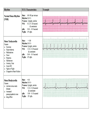 ECG Review ACLS Program Ohio State University Medical Center  Form